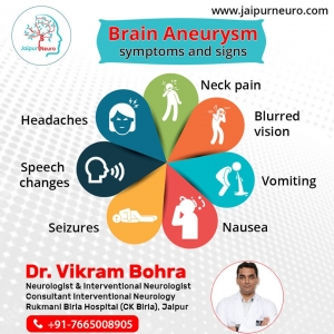 Brain Aneurysm Symptoms and Signs: